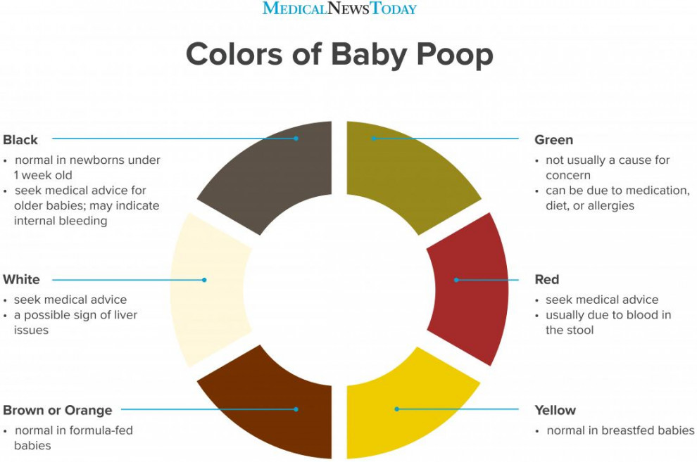 What does baby poop color mean? Chart and guide